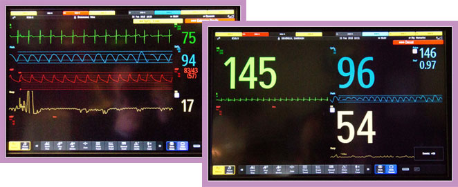 Collage of two photos showing Vital Signs Monitors and Heartbeat Monitor