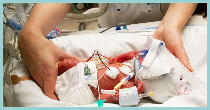 Photo of adult hands positioning a premature baby in an incubator.